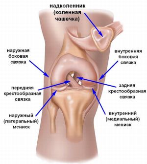 Навяхване на сухожилията на колянната става: първа помощ и лечение