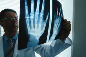 Симптомите и лечението на артрозата на китката и малките стави на ръцете