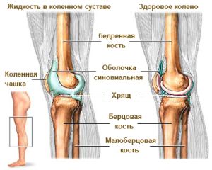 Защо течността се събира в колянната става и какво трябва да направя?