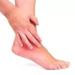 Артрит на краката: симптоми, лечение и снимка на краката