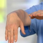 Ставна херния по китката: лечение на ставата на ръката