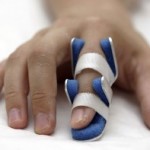 Бурсит на пръста: лечение и снимка на ставата