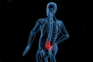 Компресионна фрактура на лумбалния гръбначен стълб: лечение и последици