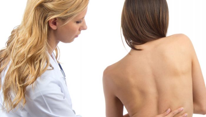 Последици от сколиозата на гръбначния стълб