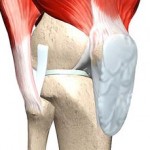Контрактура на колянната става: какво е това, лечение на коляното