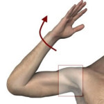 Контрактура на рамото: лечение (развитие) на рамото