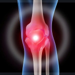 Болести на краката: причини, симптоми и лечение на заболявания