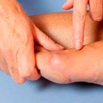 Как да се лекува артрит на крака: причини, признаци, предотвратяване на възпаление в дома