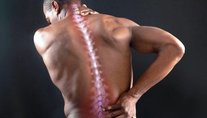 Мускулна болка в гърба: Причини и лечение