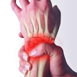 Остеоартрит на ръцете: деформация, болка и функционално увреждане