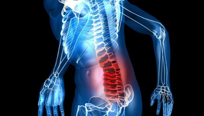 Остеохондроза на гръбнака: симптоми и лечение