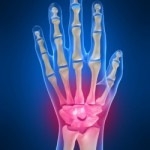 Болка в китката на дясната и лявата ръка: причини и лечение на китката