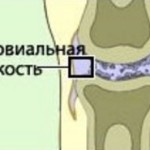 Протези на синовиална течност: препарати за колянната става