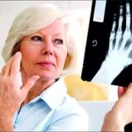 Ревматоиден артрит: прогноза за живота и продължителността му