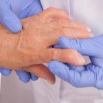 Серопозитивен ревматоиден артрит: какво е това, лечение на заболяване