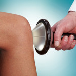Терапия с Shockwave: лечение на артроза на колянната става