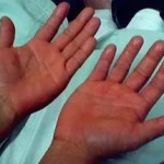 Средният и пръстеновиден пръст боли от дясната или от лявата ръка: причините за болката
