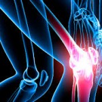 Лечение на полиартрит на ставата (коляно или в същото време всички)