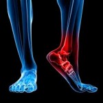 Лечение на посттравматична артроза на коленните и раменните стави