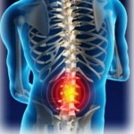 Какво е дорсопатия на лумбалните: описание (признаци и симптоми), лечение на гръбначния стълб