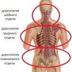 Какво е дорсопатия на лумбалните: описание (признаци и симптоми), лечение на гръбначния стълб