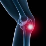 Какво представлява ентеропатията на колянната става: признаци, симптоми и лечение