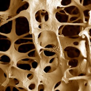 Каква е резорбцията на костната тъкан - кога и защо процесът ускорява