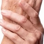 Какво представлява серонегативният ревматоиден артрит: причини, симптоми и лечение