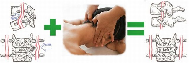 Лечение на остеохондрозата с масаж - методи за цервикалната, гръдната и лумбалната част на гръбначния стълб