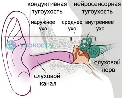 Шум в ушите с остеохондроза с цервикална остеохондроза