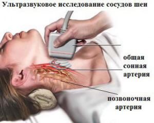 Синдром на гръбначната артерия с цервикална остеохондроза