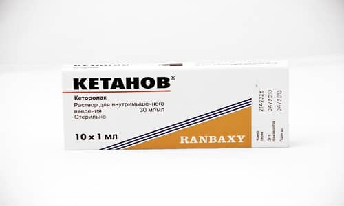 Ще помогне ли Кетанов с главоболието?