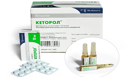 Възможности за използване на Ketorol за главоболие и други видове болка