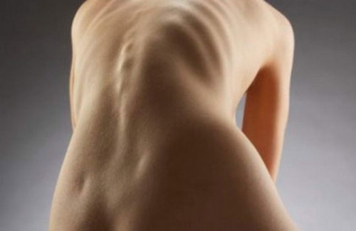 Причини за развитие и характеристики на въртенето на гръбначните тела