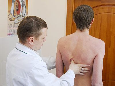 Лево- и дясна сколиоза на гръбначния стълб: симптоми, лечение