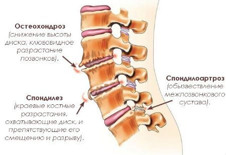 Причини за болка в гърба вдясно