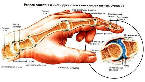 Основните причини за болка в ставите на пръстите