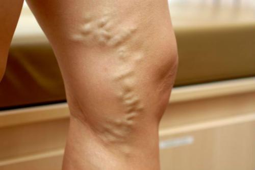 Какви са причините за болката в краката?