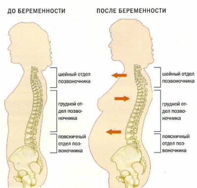 Причини за болка в гърба