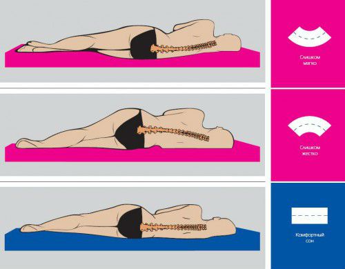 Причини за болка в гърба през нощта и след сън