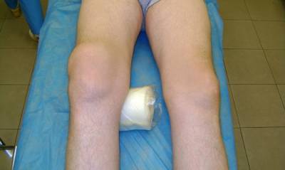 Причини за възпаление на ставите по краката и тяхното лечение