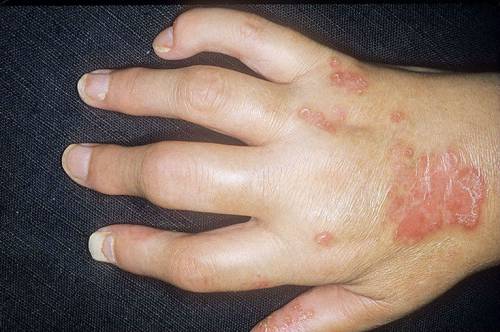 Възможни причини за болка в ставите на пръстите
