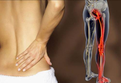 Причините за болка в крака от бедрото до коляното