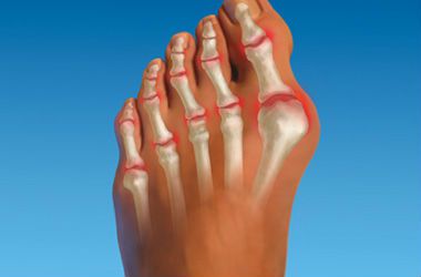 Основните причини за болка в краката