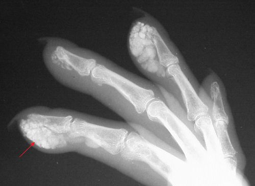Рентгеново на ръката
