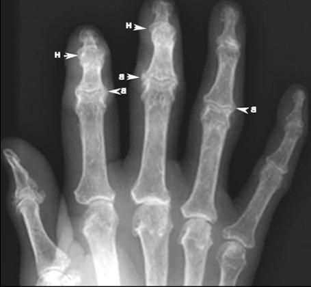 Рентгеново на ръката