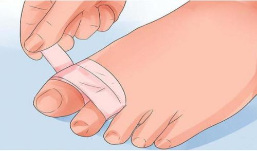 Как да определите дали пръстът е счупен на крака