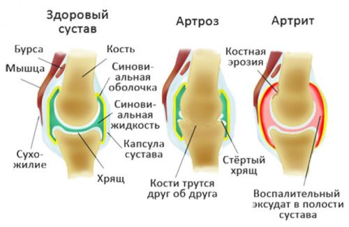Болка под коляното отпред