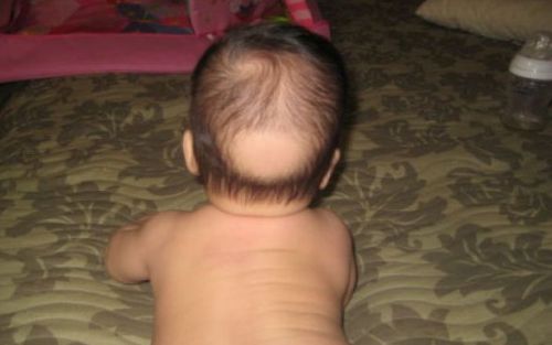 Краткото врат на новороденото