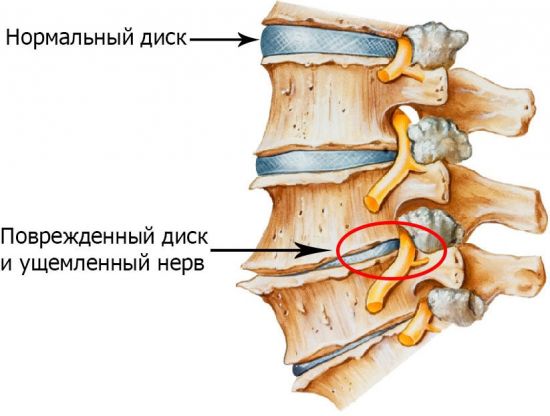 Болка в средата на гърба